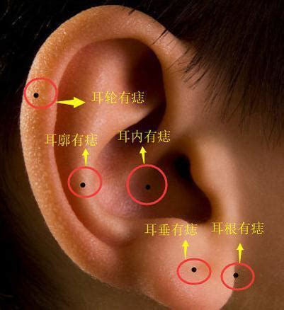 右耳有痣|耳朵长痣的位置图解 耳朵长痣的位置图解有福气